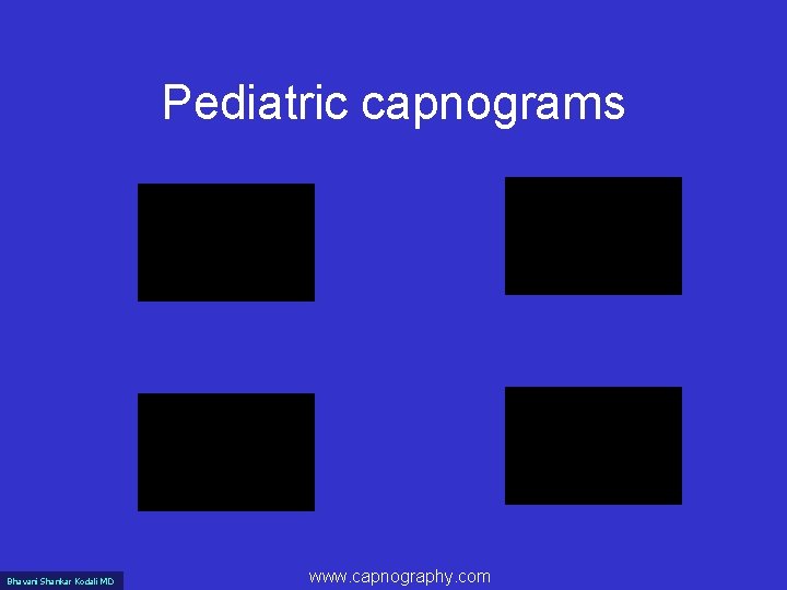 Pediatric capnograms Bhavani Shankar Kodali MD www. capnography. com 