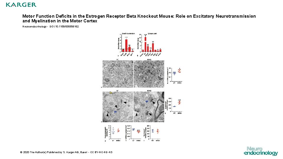 Motor Function Deficits in the Estrogen Receptor Beta