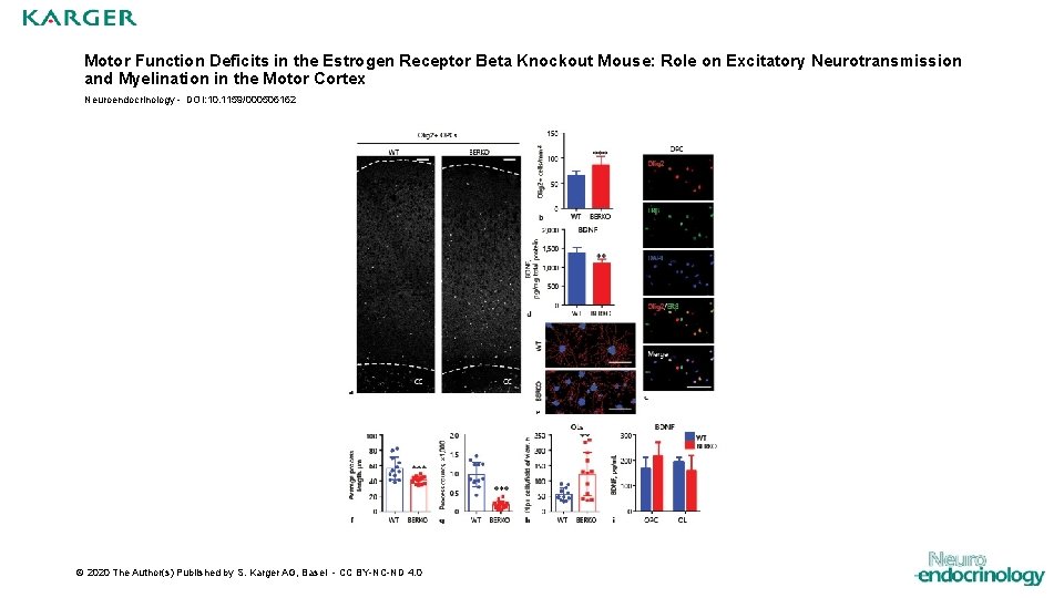 Motor Function Deficits in the Estrogen Receptor Beta