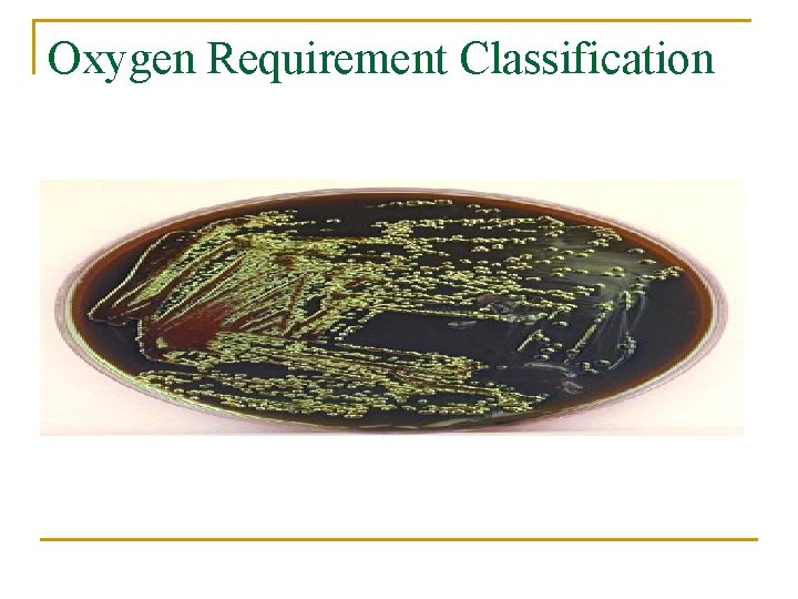 Oxygen Requirement Classification 