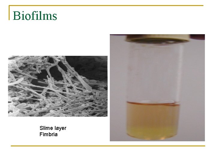 Biofilms Slime layer Fimbria 