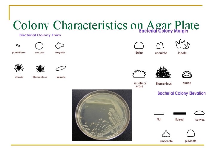 Colony Characteristics on Agar Plate 