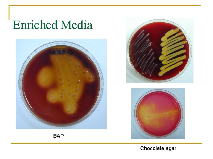 Enriched Media BAP Chocolate agar 
