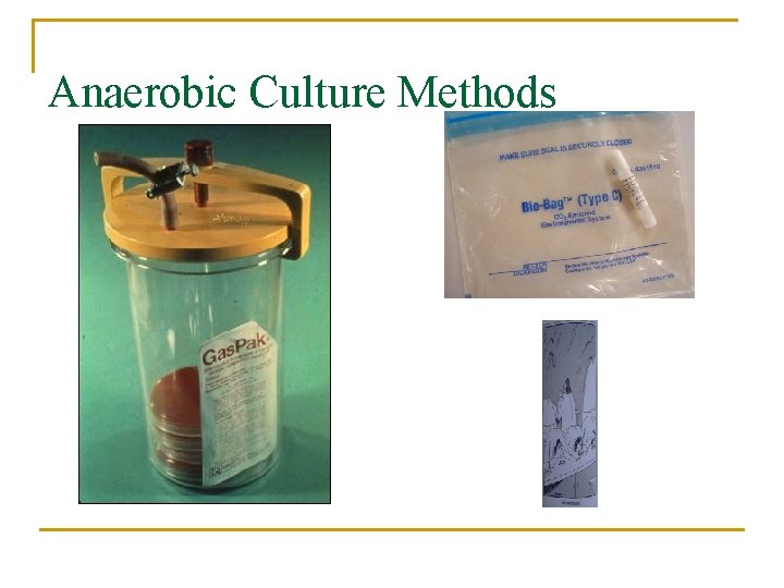 Anaerobic Culture Methods 