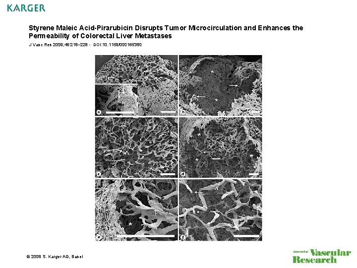 Styrene Maleic Acid-Pirarubicin Disrupts Tumor Microcirculation and Enhances the Permeability of Colorectal Liver Metastases