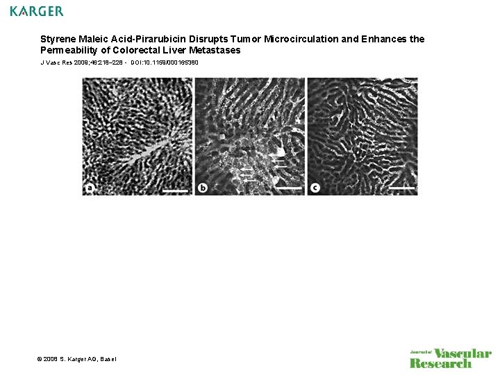 Styrene Maleic Acid-Pirarubicin Disrupts Tumor Microcirculation and Enhances the Permeability of Colorectal Liver Metastases