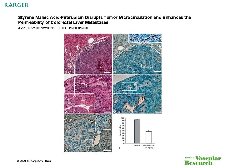 Styrene Maleic Acid-Pirarubicin Disrupts Tumor Microcirculation and Enhances the Permeability of Colorectal Liver Metastases