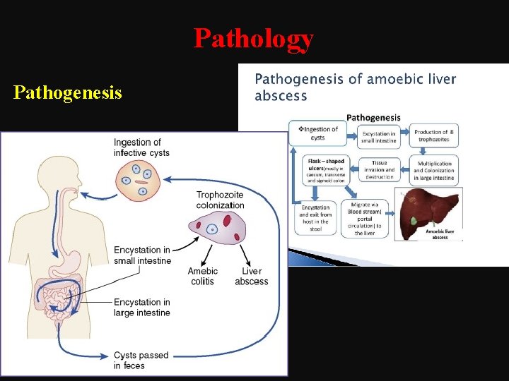 Pathology Pathogenesis 