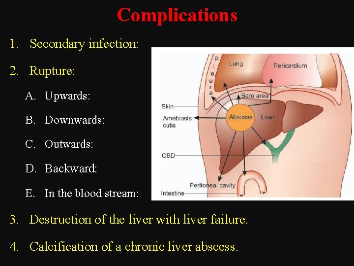 Complications 1. Secondary infection: 2. Rupture: A. Upwards: B. Downwards: C. Outwards: D. Backward: