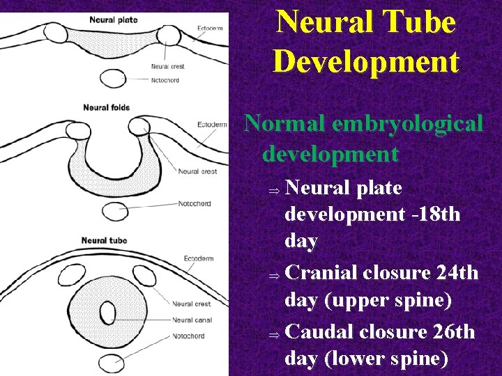 Neural Tube Development Normal embryological development Neural plate development -18 th day Þ Cranial