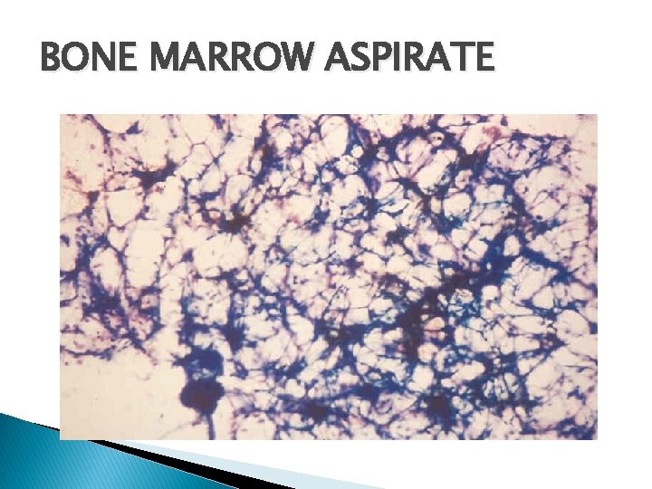 BONE MARROW ASPIRATE 