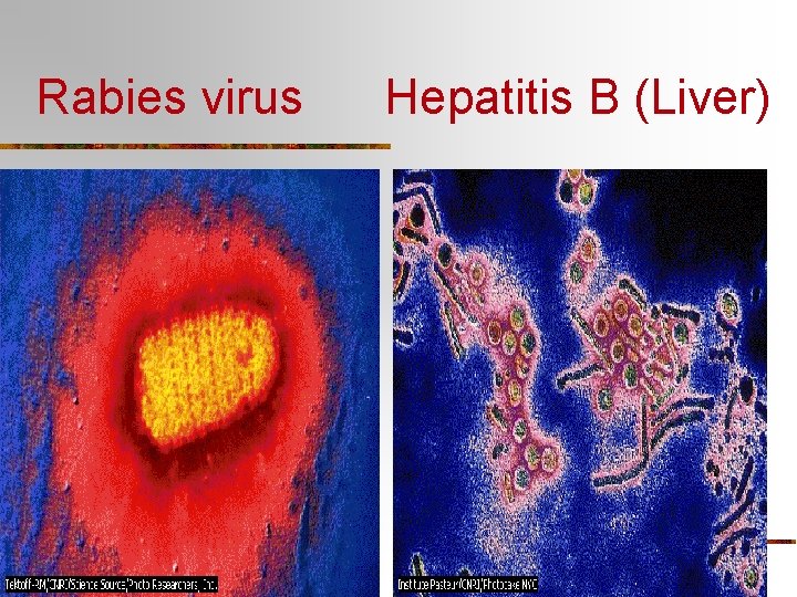 Rabies virus Hepatitis B (Liver) 
