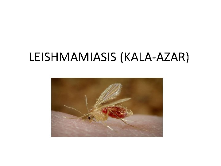 LEISHMAMIASIS (KALA-AZAR) 