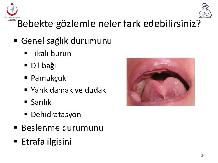 Bebekte gözlemle neler fark edebilirsiniz? § Genel sağlık durumunu § § § Tıkalı burun