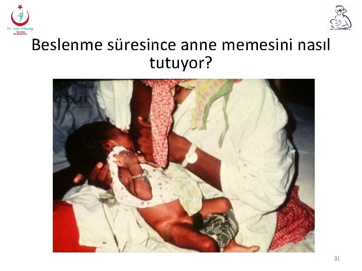 Beslenme süresince anne memesini nasıl tutuyor? 31 