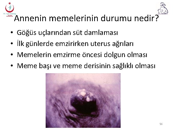 Annenin memelerinin durumu nedir? • • Göğüs uçlarından süt damlaması İlk günlerde emzirirken uterus