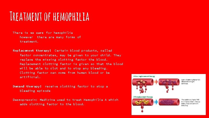 Treatment of hemophilia There is no cure for hemophilia however there are many forms