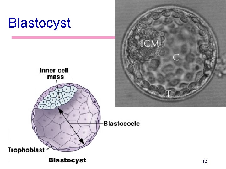 Blastocyst 12 