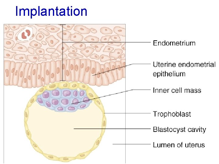 Implantation 14 