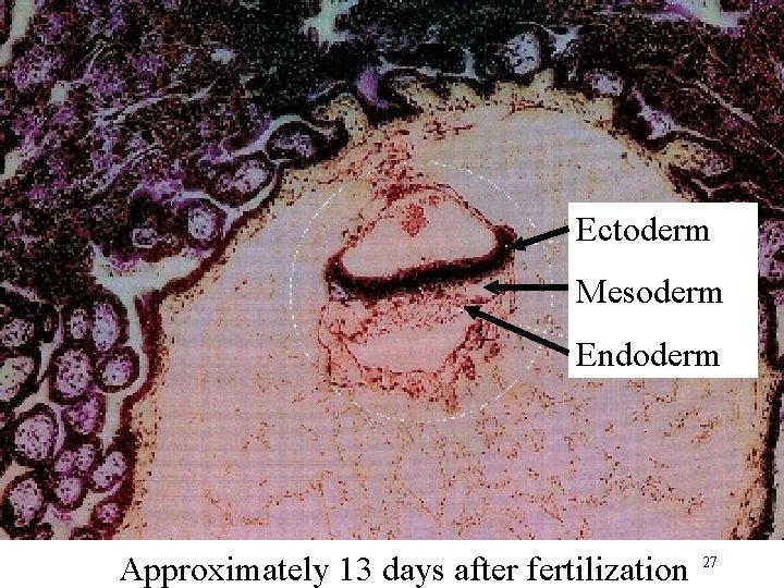 Ectoderm Mesoderm Endoderm Approximately 13 days after fertilization 27 