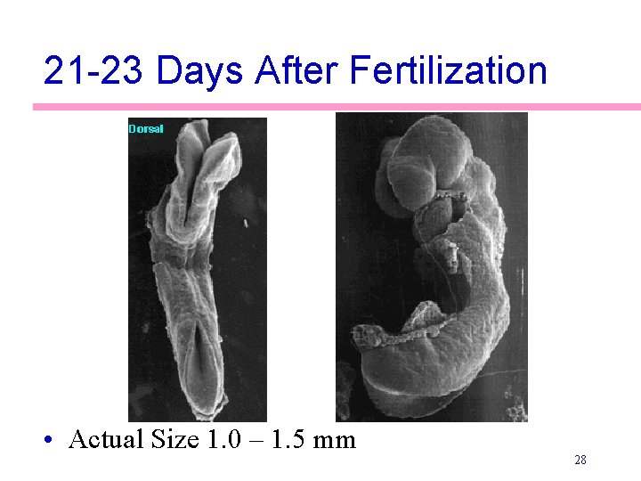 21 -23 Days After Fertilization • Actual Size 1. 0 – 1. 5 mm
