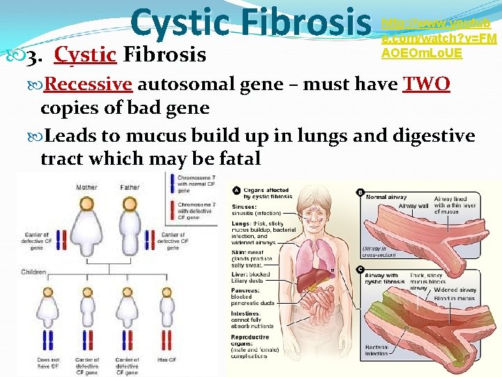 Cystic Fibrosis 3. Cystic Fibrosis http: //www. youtub e. com/watch? v=FM AOEOm. Lo. UE