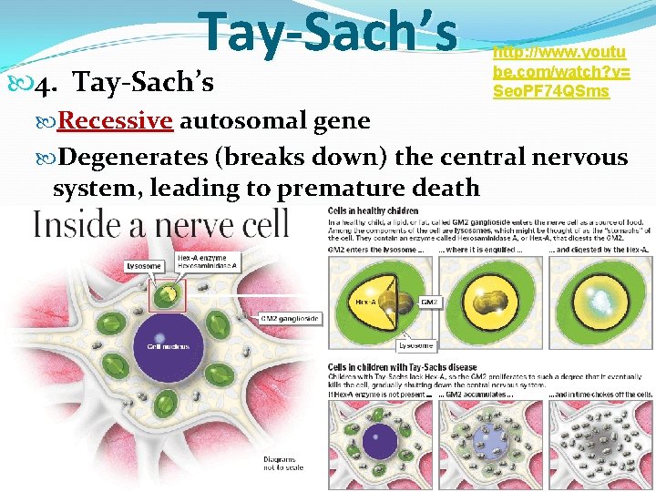 Tay-Sach’s 4. Tay-Sach’s http: //www. youtu be. com/watch? v= Seo. PF 74 QSms Recessive