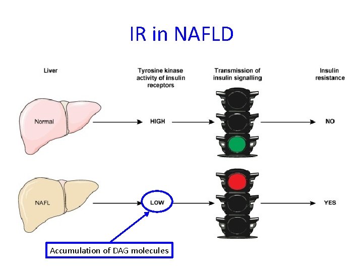 IR in NAFLD Accumulation of DAG molecules 