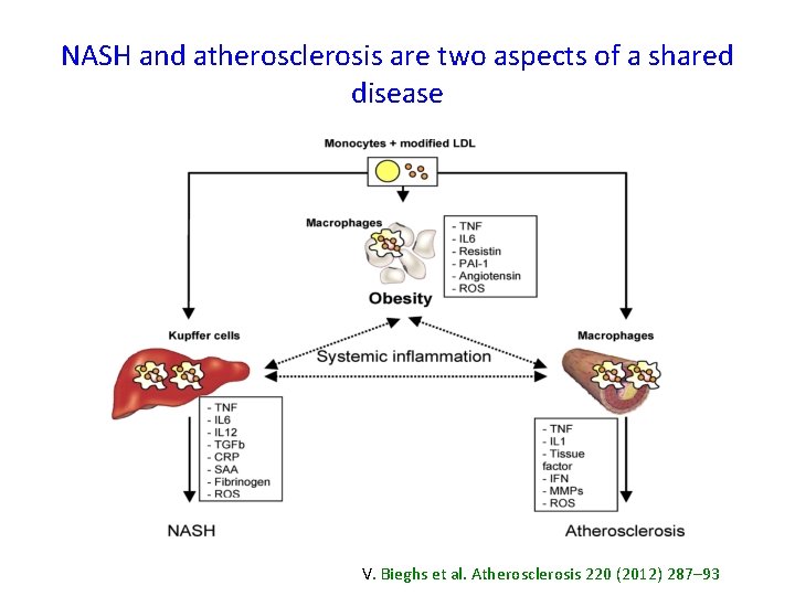 NASH and atherosclerosis are two aspects of a shared disease V. Bieghs et al.