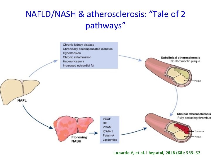 NAFLD/NASH & atherosclerosis: “Tale of 2 pathways” Lonardo A, et al. J hepatol, 2018
