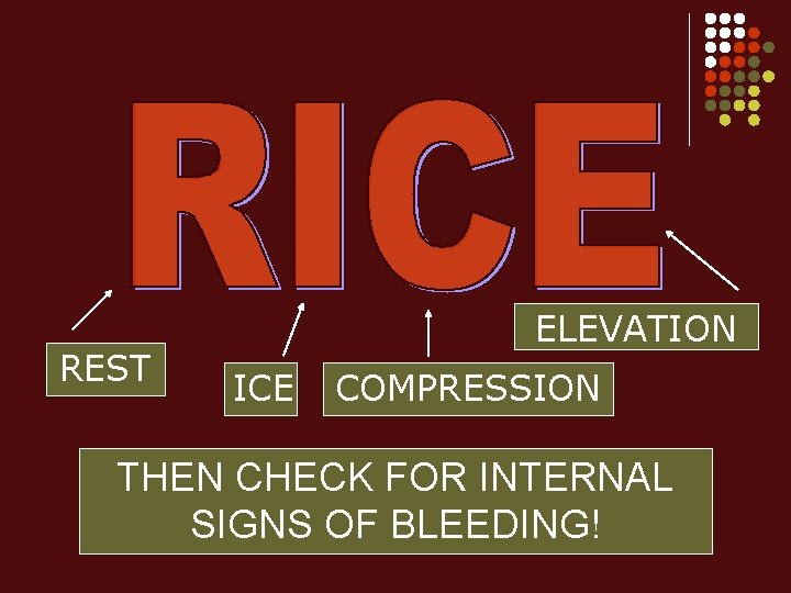 REST ELEVATION ICE COMPRESSION THEN CHECK FOR INTERNAL SIGNS OF BLEEDING! 