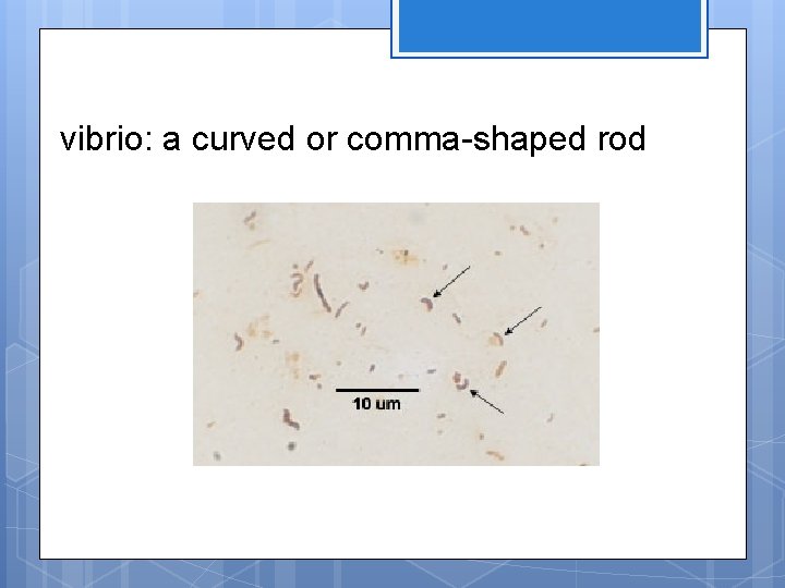 vibrio: a curved or comma-shaped rod 