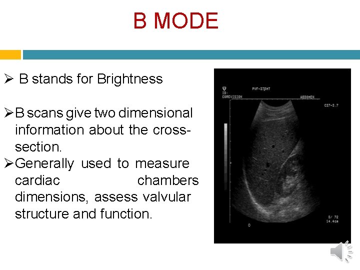 B MODE B stands for Brightness B scans give two dimensional information about the