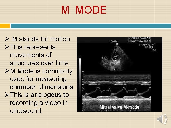 M MODE M stands for motion This represents movements of structures over time. M