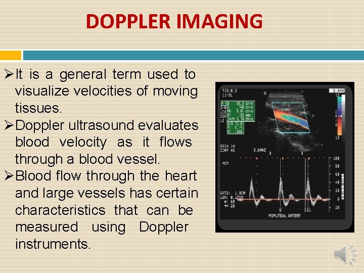 DOPPLER IMAGING It is a general term used to visualize velocities of moving tissues.