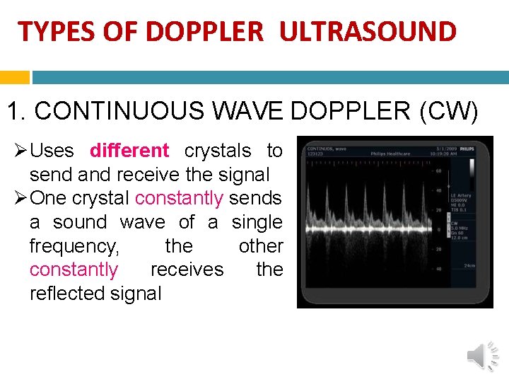 TYPES OF DOPPLER ULTRASOUND 1. CONTINUOUS WAVE DOPPLER (CW) Uses different crystals to send