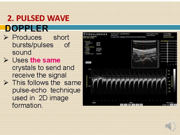 2. PULSED WAVE DOPPLER Produces short bursts/pulses of sound Uses the same crystals to