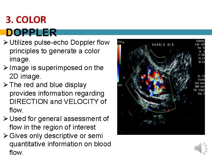3. COLOR DOPPLER Utilizes pulse-echo Doppler flow principles to generate a color image. Image