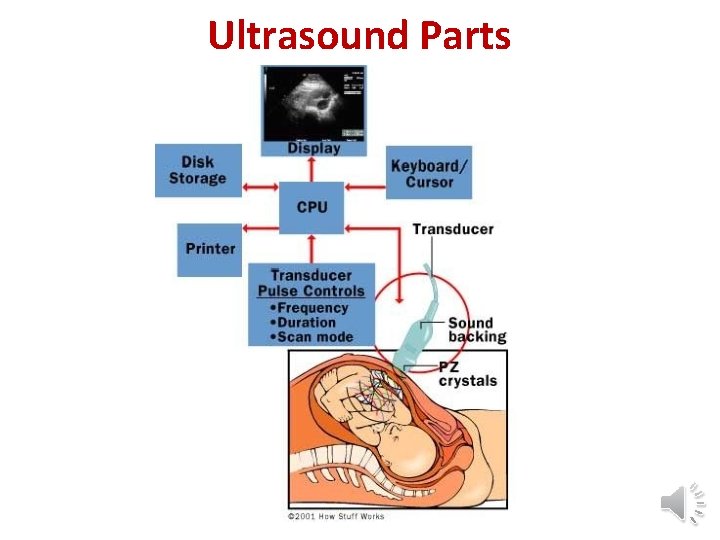 Ultrasound Parts 