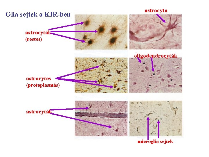Glia sejtek a KIR-ben astrocyta astrocyták (rostos) oligodendrocyták astrocytes (protoplasmás) astrocyták microglia sejtek 
