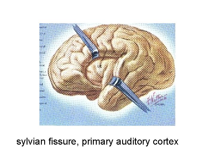 sylvian fissure, primary auditory cortex 