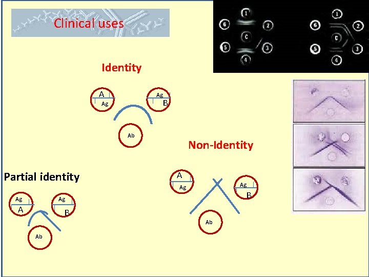 Clinical uses Identity A Ag B Ag Ab Partial identity Ag Non-Identity A Ag