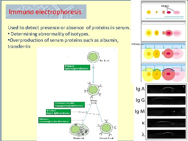Immuno electrophoresis Used to detect presence or absence of proteins in serum. • Determining