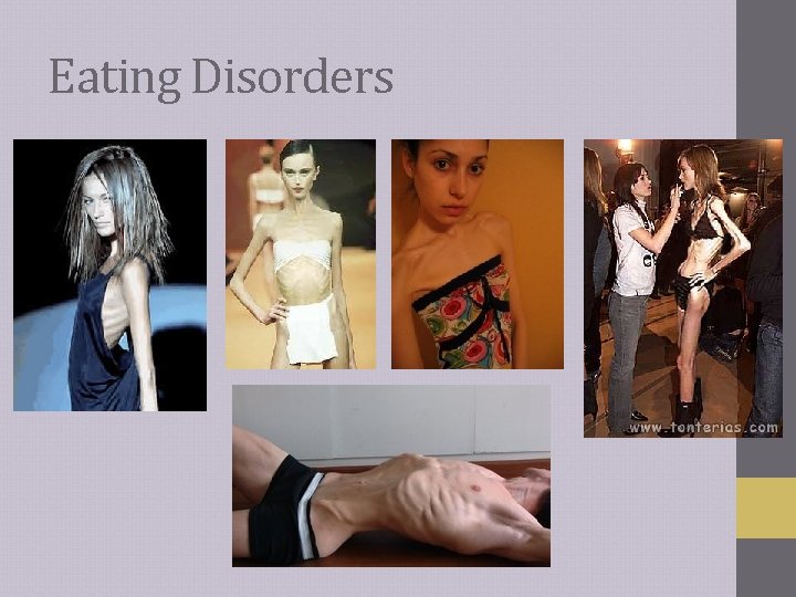 Eating Disorders 