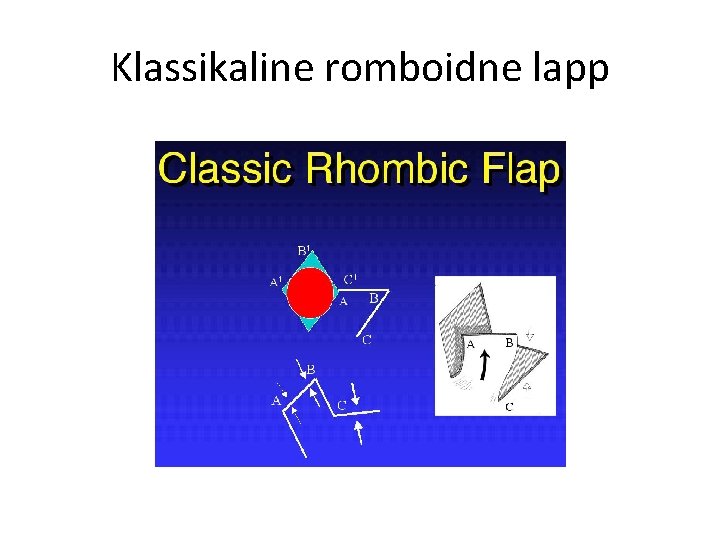 Klassikaline romboidne lapp 