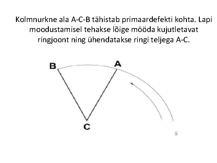 Kolmnurkne ala A-C-B tähistab primaardefekti kohta. Lapi moodustamisel tehakse lõige mööda kujutletavat ringjoont ning