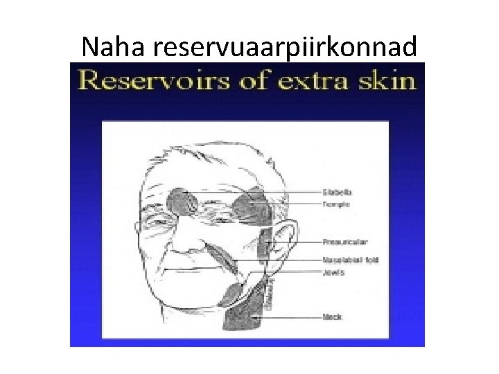 Naha reservuaarpiirkonnad 