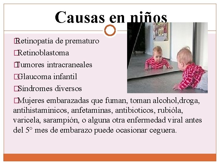 Causas en niños � Retinopatía de prematuro �Retinoblastoma � Tumores intracraneales �Glaucoma infantil �Síndromes