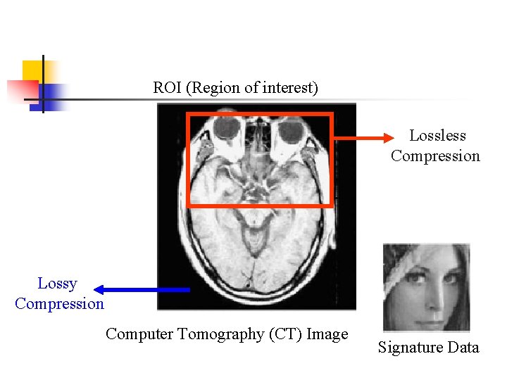 ROI (Region of interest) Lossless Compression Lossy Compression Computer Tomography (CT) Image Signature Data