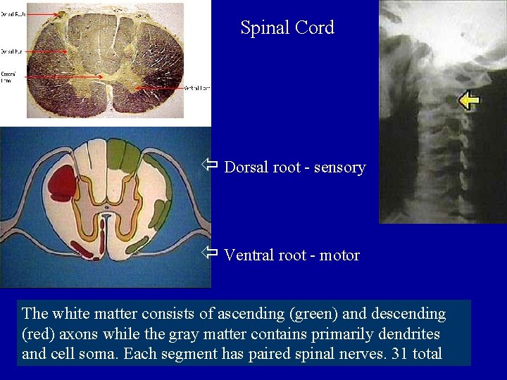 Spinal Cord Dorsal root - sensory Ventral root - motor The white matter consists